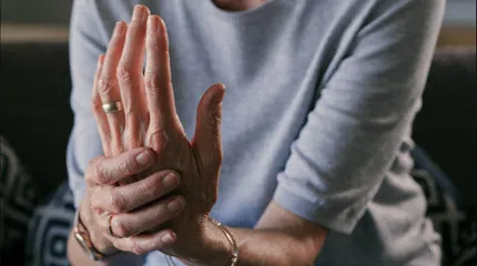 Close-up of a woman holding and stretching a hand, illustrating hand pain and stiffness associated with arthritis.