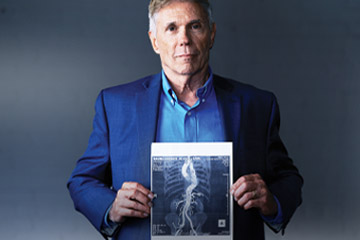 The featured patient, Earl, holding up an image of his aortic aneurysm